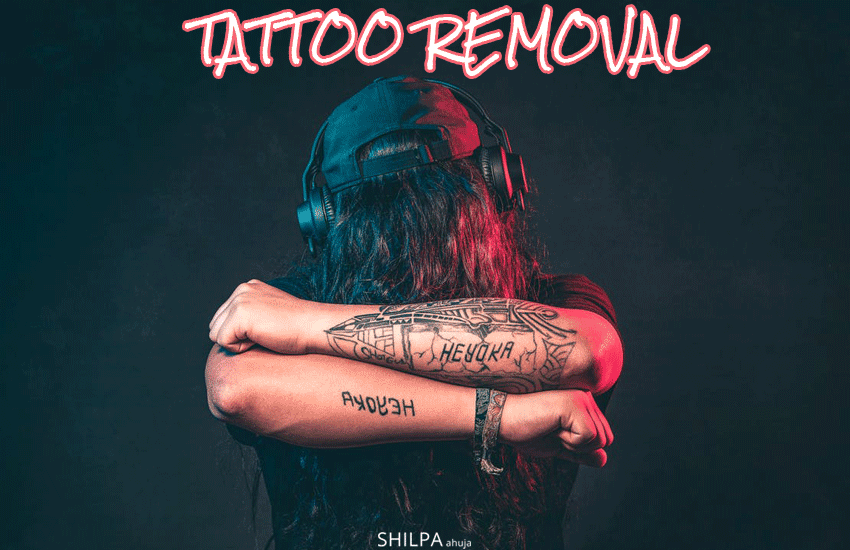 tattoo-removal-ideas-tattoos-ways-home-treatment-laser