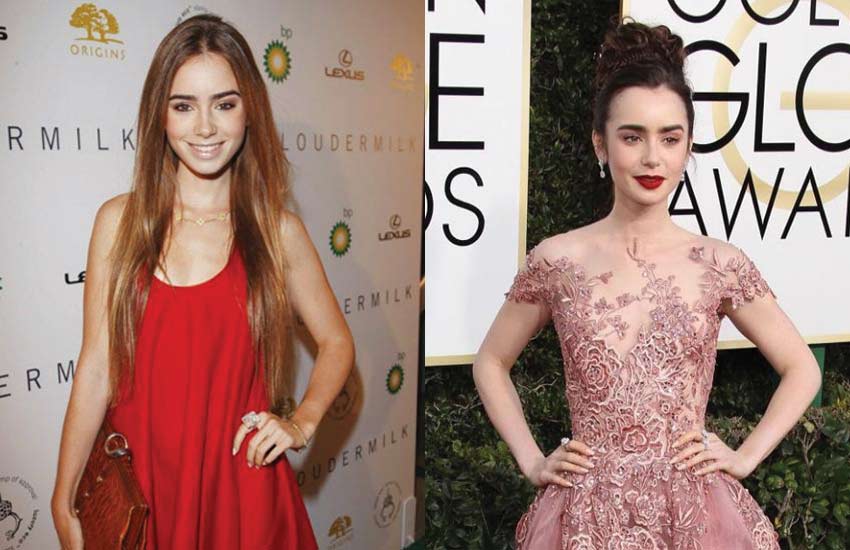 famous-celebrity-eating-disorder-treatment-celeb (5)-lily-collins