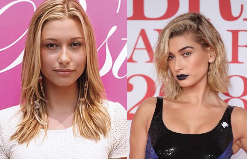 hailey-baldwin-before-after-photos-plastic-surgery-nose-job