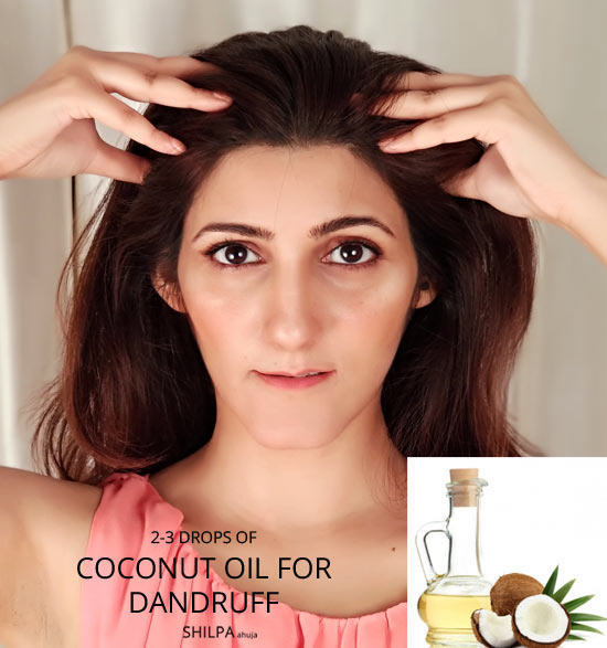 COCONUT-oil-for-hair-how-to-get-rid-of-dandruff-remedies-urgent